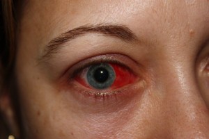 My zombie eye